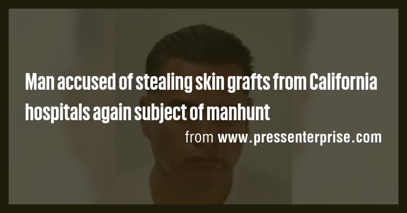 Man accused of stealing skin grafts from California hospitals again ...