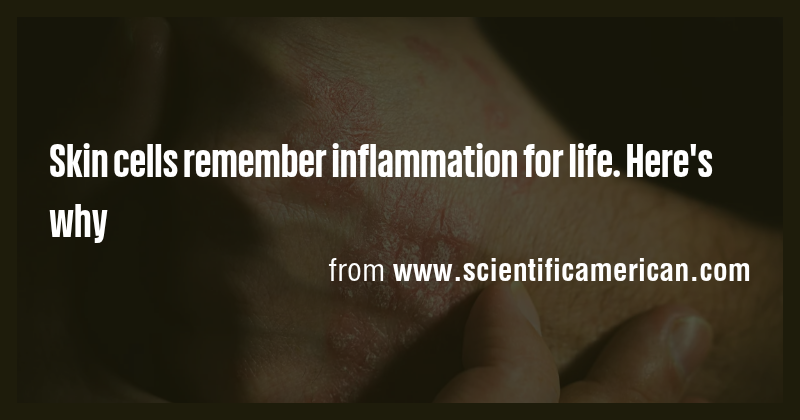 Skin cells remember inflammation for life. Here's why - Briefly