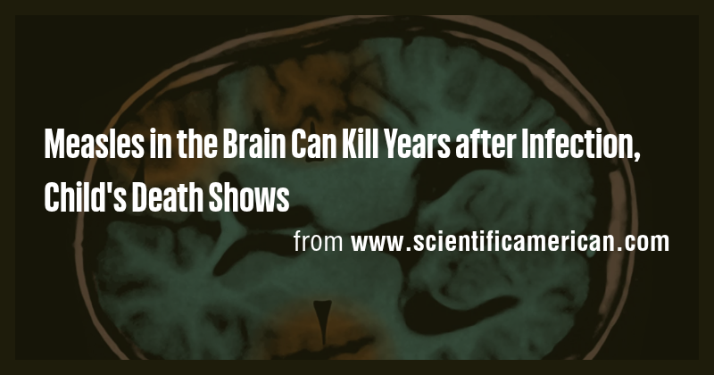 Measles in the Brain Can Kill Years after Infection, Child's Death ...